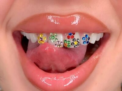teeth jewelry