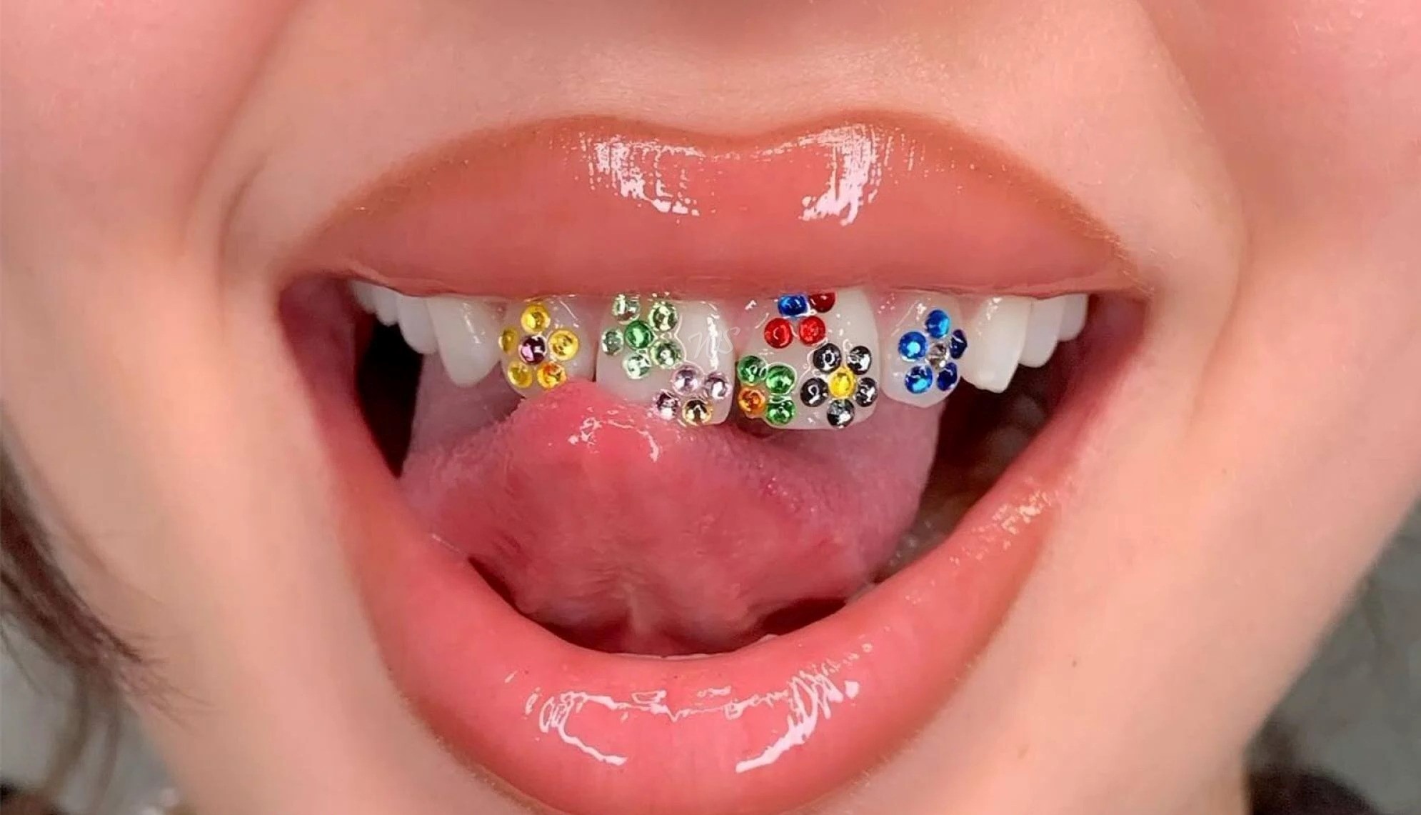 teeth jewelry